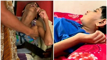 തീരാദുരിതം; എന്ഡോസള്ഫാന് ഇരകള്ക്ക് അഞ്ചുമാസമായി പെന്ഷനില്ല, ചിങ്ങം ഒന്നിന് ഉപവാസം