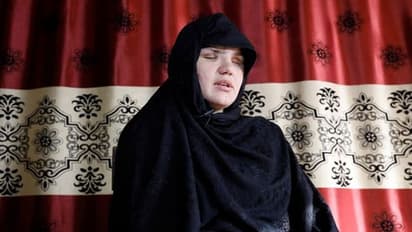 महिलाओं को कुत्तों से कटवाते हैं, तालिबान की शिकार महिला ने कहा- उन्होंने मेरी आंखें निकाल ली