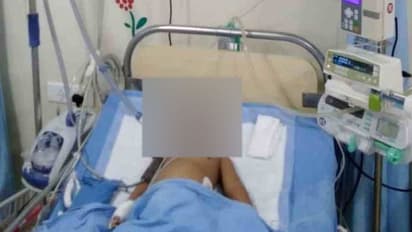 చిత్తూరు: అటవీ ఆముదం గింజలు తిని... 25 మంది చిన్నారులకు అస్వస్థత