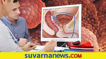 ಪ್ರಾಸ್ಟೇಟ್ ಕ್ಯಾನ್ಸರ್ ಅಪಾಯ ಯಾರಿಗೆ ಜಾಸ್ತಿ? ಯಾರಿಗೆ ಕಡಿಮೆ? ನಿತ್ಯ ಸ್ಖಲನ ಪರಿಹಾರವೇ?