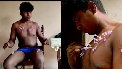 30 സെക്കന്റ്, 110 സൂചി; ശരീരത്തിൽ സൂചി കുത്തി റെക്കോർഡുമായി യുവാവ്