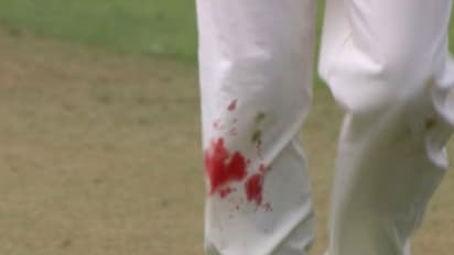 #ENGvsIND 39 வயதில் ரத்தம் சொட்டச்சொட்ட விளையாடிய ஆண்டர்சன்..! வியக்கவைக்கும் ஆண்டர்சனின் அர்ப்பணிப்பு