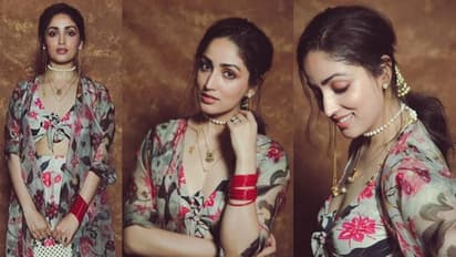 ಫೇರ್‌ನೆಸ್ ಕ್ರೀಂ ಜಾಹಿರಾತಿನ ಯಾಮಿ ಗೌತಮ್‌ಗಿದೆ ಈ ಚರ್ಮ ರೋಗ; ಇದರ ಲಕ್ಷಣಗಳೇನು?