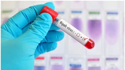 നിപ വൈറസ്; സ്വീകരിക്കേണ്ട മുന്‍കരുതലുകള്‍ എന്തൊക്കെ...?