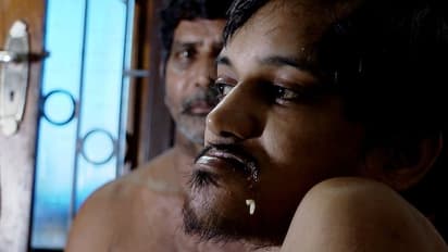 സുമനസുകൾ കനിയണം; രഞ്ജിത്തിന് തുടർ ചികിൽസ വേണം