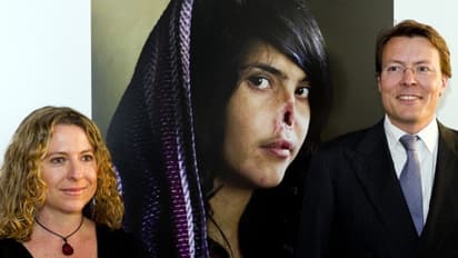 घसीटकर पहाड़ पर ले गए, पीटा-नाक कान काट दिए, फिर पति ने चेहरा कुचला, कहानी जिसने दुनिया को झकझोरा था...