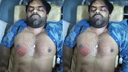 హైదరాబాద్: మాదాపూర్ కేబుల్ బ్రిడ్జిపై ప్రమాదం.. హీరో సాయిధరమ్ తేజ్కు తీవ్రగాయాలు