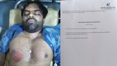 అపోలో వైద్యుల లేటెస్ట్ బులెటిన్: నిలకడగా సాయి ధరమ్ హెల్త్ కండిషన్.. ఐసీయూలోనే చికిత్స!