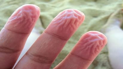 বেশিক্ষণ জলের সংস্পর্শে থাকলে কুঁচকে যায় আঙুলের চামড়া, কেন জানেন