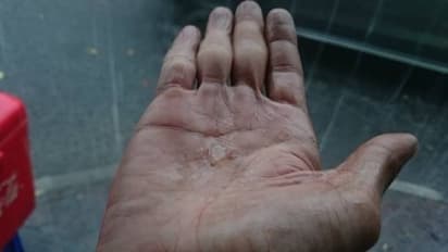 হাতে আঙুলের ফাঁকেই রয়েছে টাকা তথ্য, সামুদ্রিকশাস্ত্র অনুযায়ী ৬টি লক্ষণ বলবে অর্থনৈতিক জীবন