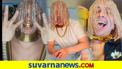 ತಲೆಗೆ ಕೂದಲ ಬದಲು ಚಿನ್ನದ ಚೈನ್ಸ್ ಫಿಕ್ಸ್ ಮಾಡಿಸಿದ ರ‍್ಯಾಪರ್