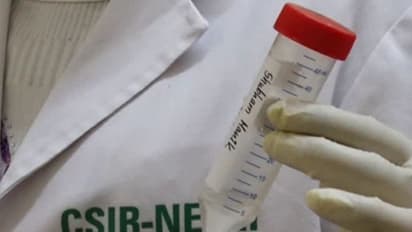 कोरोना के खिलाफ लड़ाई में मदद करेगी सेलाइन गार्गल RT-PCR तकनीकी, ग्रामीण इलाकों को भी फायदा