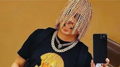 ശസ്ത്രക്രിയയിലൂടെ തലയില് സ്വര്ണച്ചെയിനുകള് തുന്നിച്ചേര്ത്തു, കയ്യില് സ്വര്ണക്കട്ടകള്, പല്ലിലും സ്വര്ണം