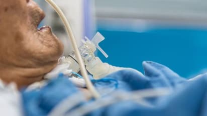 ಅಮೆರಿಕದಲ್ಲಿ 7 ಲಕ್ಷ ಜನರ ಸಾವು, 4.4 ಕೋಟಿ ಜನರಿಗೆ ಸೋಂಕು!