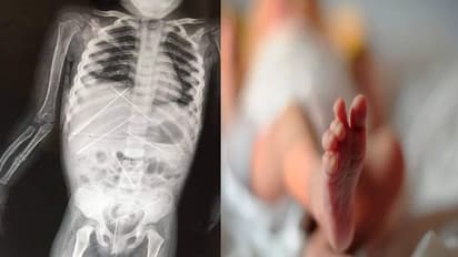 সারা শরীরে সূঁচের যন্ত্রণা নিয়ে মৃত শিশু বিচার পাবে কি, পুরুলিয়া কান্ডে আজ সাজা ঘোষণা