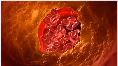 cholesterol : ഈ പഴം ചീത്ത കൊളസ്ട്രോൾ കുറയ്ക്കാൻ സഹായിക്കും