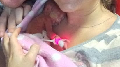 Premature ಮಗುವಿನ ಪಾಲನೆ ಹೀಗಿರಲಿ