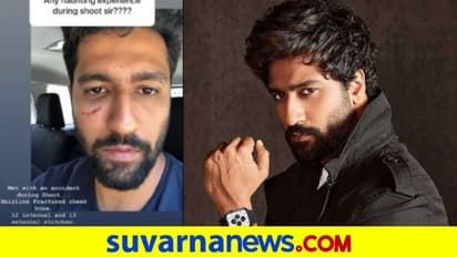 ಶೂಟಿಂಗ್ ವೇಳೆ ಗಾಯ: ಕತ್ರೀನಾ ಬಾಯ್‌ಫ್ರೆಂಡ್ ಗಲ್ಲದಲ್ಲಿ 25 ಸ್ಟಿಚ್