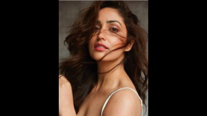 ಫೇರ್‌ & ಲವ್ಲಿ ಚೆಲುವೆಗೆ ತ್ವಚೆ ಸಮಸ್ಯೆ: ಇದಕ್ಕೆ ಮದ್ದೇ ಇಲ್ಲ