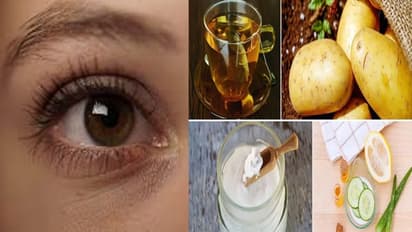 కంటి కింద డార్క్ సర్కిల్స్ తగ్గాలంటే ఈ చిట్కాలు పాటించండి.. వెంటనే మార్పులు?