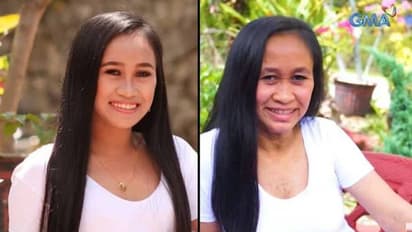 വയസ് വെറും 16, കണ്ടാൽ വൃദ്ധയെ പോലെ അപൂർവാവസ്ഥയുമായി പെൺകുട്ടി...