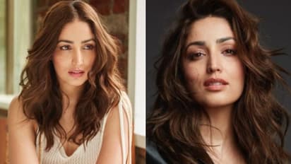 ഇത് കൗമാരം മുതലുള്ള ചര്‍മ്മപ്രശ്നം; തുറന്നുപറഞ്ഞ് യാമി ഗൗതം