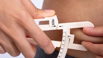 വണ്ണം കുറയ്ക്കുന്നതിന് വേണ്ടി ചെയ്യുന്ന സര്ജറിയുടെ പാര്ശ്വഫലം...