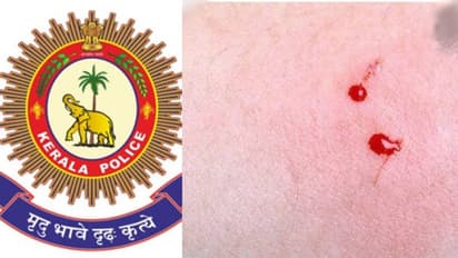 പാമ്പുകടിയേറ്റ യുവതിയെ ആശുപത്രിയിലെത്തിച്ച് രക്ഷകരായി പൊലീസ്