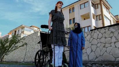 ലോകത്തിലെ ഏറ്റവും ഉയരം കൂടിയ വനിത; നേട്ടത്തിന് പിന്നിലെ വേദന...