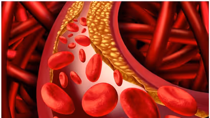 Control Cholesterol : ഉയര്‍ന്ന കൊളസ്ട്രോള്‍ നിയന്ത്രിക്കാന്‍ സഹായിക്കുന്ന മികച്ച അഞ്ച് ഭക്ഷണങ്ങളിതാ...
