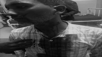 పెద్దపల్లి: పదిరూపాయల సిగరెట్ కోసం... గొడుగుతో గొంతులో పొడిచి హత్యాయత్నం (వీడియో)