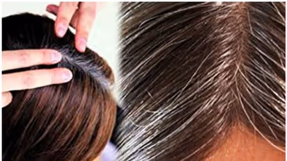 Hair Care Tips- কম বসেই ঢাকতে হচ্ছে মাথা, পাক ধরছে চুলে, তবে এবার মাথায় রাখুন এই টিপস