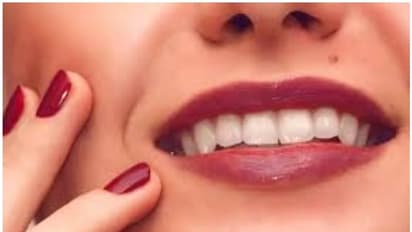 Skin Care: முகத்தின் அழகை மருக்கள் வந்து கெடுகிறதா? இதோ இந்த எளிய வீட்டு வைத்திய முறைகளை பின்பற்றி பாருங்கள்..