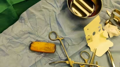 இப்படியும் ஒரு மனுசனா..? செல்போனை முழுங்கிய இளைஞர்… கடைசியில் டுவிஸ்ட்