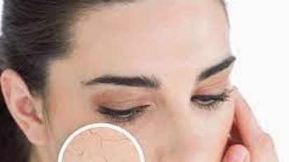 கோடை சரும பிரச்சனைகளை தவிர்க்க இந்த வீட்டு வைத்தியம் ஃபாலோ பண்ணுங்க..!!