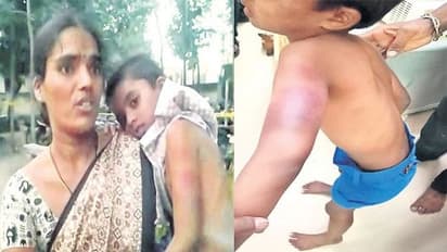 దారుణం.. నోట్లో నుంచి ‘ఉమ్ము’ పడిందని.. చిన్నారిని చితకబాదిన టీచర్...