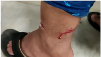 ആശുപത്രിയില് ക്യൂ നില്ക്കവെ വീട്ടമ്മക്ക് തെരുവ് നായയുടെ കടിയേറ്റു; ചികിത്സ വൈകിയെന്ന് ആരോപണം