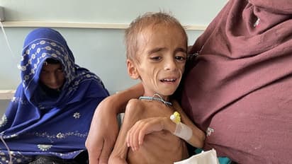 വിസ്മയമല്ല, യാഥാര്‍ത്ഥ്യം; അഫ്ഗാന്‍, കുരുന്നുകളുടെ ശവപ്പറമ്പാകുമെന്ന മുന്നറിയിപ്പുമായി യുഎന്‍