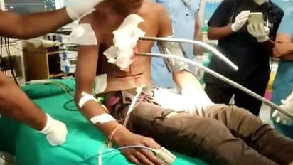 40 फीट लंबे लोहे के 2 सर‍िये सीने को चीरते हुए निकले आर-पार, हिम्मत देख दंग रह गए..फिर हुआ एक चमत्कार