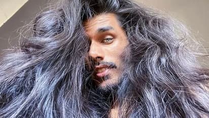 बालों की कीमत समझने वाला इंसान! गंजा हो चुका था, लेकिन जब दोबारा उगे तो खाई सबसे बड़ी कसम, आप भी सीख सकते हैं