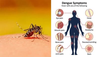 Dengue Outbreak| 9 ರಾಜ್ಯಗಳಿಗೆ ಡೆಂಗ್ಯೂ ಅಪಾಯ, ಕೇಂದ್ರದ ತಂಡ ದೌಡು!