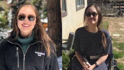 വണ്ടിയിടിച്ച് രണ്ടാഴ്ച കോമയിൽ കിടന്നു, ഉണർന്ന് കഴിഞ്ഞപ്പോൾ യുവതി സംസാരിക്കുന്നത് വിദേശഭാഷാ ശൈലിയിൽ