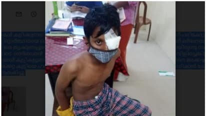 പത്താം ക്ലാസ് വിദ്യാര്ത്ഥിക്ക് അയല്ക്കാരന്റെ ക്രൂരമര്ദ്ദനം; കണ്ണിന് ഗുരുതര പരിക്ക്