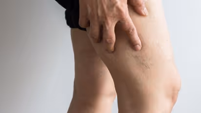 Cancer Symptom : കാലില്‍ കാണപ്പെടുന്ന ക്യാന്‍സര്‍ ലക്ഷണം...