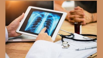 World Pneumonia Day: जानलेवा हो सकता है इसका संक्रमण, जानें लक्षण और इलाज का तरीका