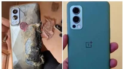 മൊബൈല് പൊട്ടിത്തെറിച്ച് യുവാവിന് പൊള്ളല്; നഷ്ടപരിഹാരം നല്കി വണ്പ്ലസ്