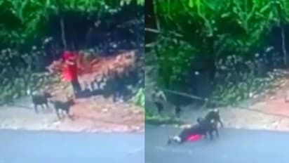 താമരശ്ശേരിയിൽ വളർത്തുനായയുടെ ആക്രമണത്തിൽ യുവതിക്ക് ഗുരുതര പരിക്ക്