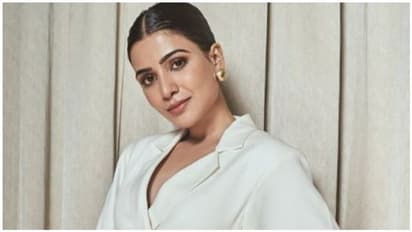 Samantha: జ్ఞాపకాలు చెరిపేసినా సమంత ఒంటిపై నాగ చైతన్య గుర్తులు చెరిగిపోలేదు.. మరి వాటినేమి చేస్తుంది!