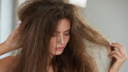 Hair Care| ആരോഗ്യമുള്ള തലമുടിക്കായി കഴിക്കാം ഈ ആറ് ഭക്ഷണങ്ങള്‍...