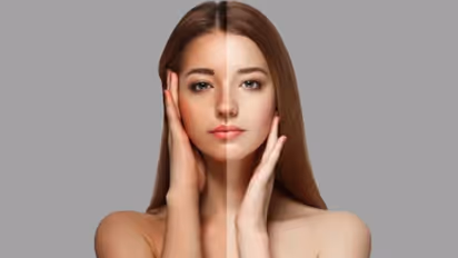 Sun Tan | മുഖത്തെ കരുവാളിപ്പ് മാറ്റാന്‍ പരീക്ഷിക്കാം ഈ അഞ്ച് ഫേസ് പാക്കുകൾ...